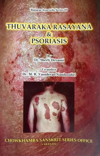 Thuvaraka Rasayan & Psoriasis